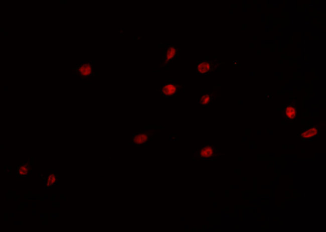 PRKDC / DNA-PKcs Antibody - Staining K562 cells by IF/ICC. The samples were fixed with PFA and permeabilized in 0.1% Triton X-100, then blocked in 10% serum for 45 min at 25°C. The primary antibody was diluted at 1:200 and incubated with the sample for 1 hour at 37°C. An Alexa Fluor 594 conjugated goat anti-rabbit IgG (H+L) antibody, diluted at 1/600, was used as secondary antibody.