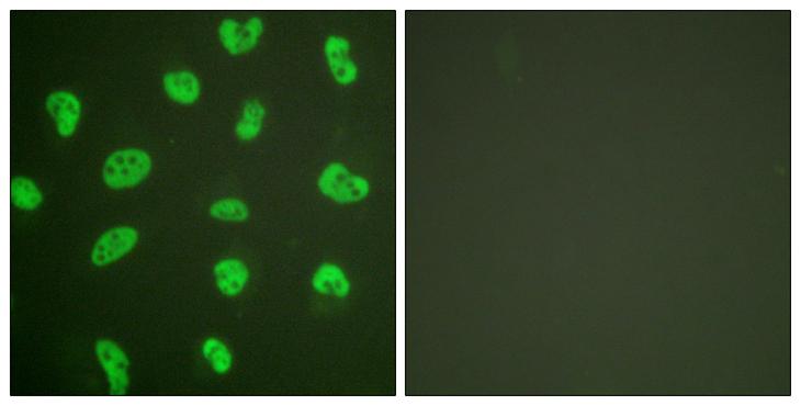 PRKDC / DNA-PKcs Antibody - Forskolin + - Immunofluorescence analysis of HeLa cells, treated with Forskolin (40nM, 30mins), using DNA-PK antibody.