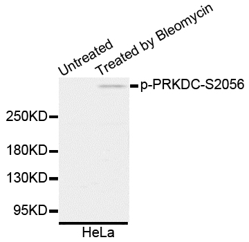 PRKDC / DNA-PKcs Antibody - Western blot analysis of extracts of HeLa cells.
