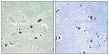 PRKDC / DNA-PKcs Antibody - Immunohistochemistry analysis of paraffin-embedded human brain, using DNA-PK (Phospho-Ser2612) Antibody. The picture on the right is blocked with the phospho peptide.