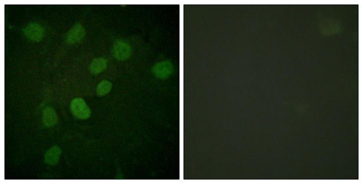 PRKDC / DNA-PKcs Antibody - Immunofluorescence analysis of HUVEC cells treated with serum 20% 30', using DNA-PK (Phospho-Thr2638) Antibody. The picture on the right is blocked with the phospho peptide.