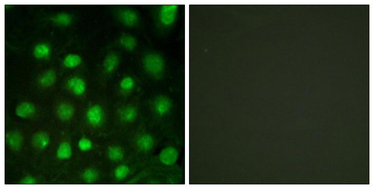 PRKDC / DNA-PKcs Antibody - Immunofluorescence analysis of HUVEC cells treated with serum 20% 30', using DNA-PK (Phospho-Thr2647) Antibody. The picture on the right is blocked with the phospho peptide.