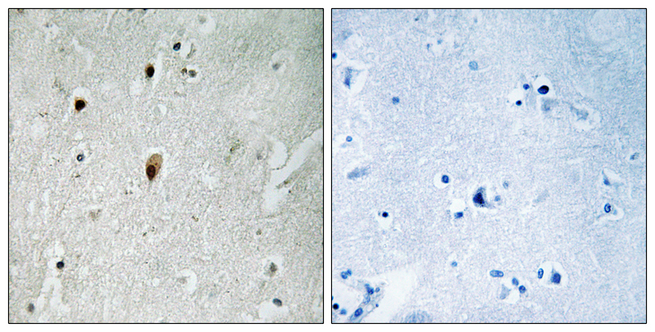 PRKDC / DNA-PKcs Antibody - Immunohistochemistry analysis of paraffin-embedded human brain, using DNA-PK (Phospho-Thr2647) Antibody. The picture on the right is blocked with the phospho peptide.