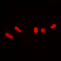 PRKDC / DNA-PKcs Antibody - Immunofluorescent analysis of DNA-PKcs (pT2647) staining in Jurkat cells. Formalin-fixed cells were permeabilized with 0.1% Triton X-100 in TBS for 5-10 minutes and blocked with 3% BSA-PBS for 30 minutes at room temperature. Cells were probed with the primary antibody in 3% BSA-PBS and incubated overnight at 4 deg C in a humidified chamber. Cells were washed with PBST and incubated with a DyLight 594-conjugated secondary antibody (red) in PBS at room temperature in the dark. DAPI was used to stain the cell nuclei (blue).