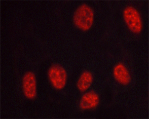 PRKDC / DNA-PKcs Antibody - Staining HuvEc cells treated with serum 20% 30' cells by IF/ICC. The samples were fixed with PFA and permeabilized in 0.1% saponin prior to blocking in 10% serum for 45 min at 37°C. The primary antibody was diluted 1/400 and incubated with the sample for 1 hour at 37°C. A Alexa Fluor 594 conjugated goat polyclonal to rabbit IgG (H+L), diluted 1/600 was used as secondary antibody.