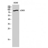 PRKG2 / CGKII Antibody - Western blot of cGKII antibody