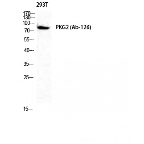 PRKG2 / CGKII Antibody - Western blot of cGKII antibody