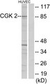 PRKG2 / CGKII Antibody - Western blot analysis of lysates from HUVEC cells, using CGK 2 Antibody. The lane on the right is blocked with the synthesized peptide.