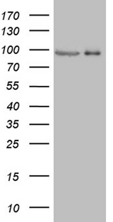 PRKG2 / CGKII Antibody - HEK293T cells were transfected with the pCMV6-ENTRY control. (Left lane) or pCMV6-ENTRY PRKG2. (Right lane) cDNA for 48 hrs and lysed. Equivalent amounts of cell lysates. (5 ug per lane) were separated by SDS-PAGE and immunoblotted with anti-PRKG2. (1:500)