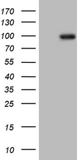 PRKG2 / CGKII Antibody - HEK293T cells were transfected with the pCMV6-ENTRY control. (Left lane) or pCMV6-ENTRY PRKG2. (Right lane) cDNA for 48 hrs and lysed. Equivalent amounts of cell lysates. (5 ug per lane) were separated by SDS-PAGE and immunoblotted with anti-PRKG2. (1:2000)