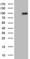 PRKG2 / CGKII Antibody - HEK293T cells were transfected with the pCMV6-ENTRY control. (Left lane) or pCMV6-ENTRY PRKG2. (Right lane) cDNA for 48 hrs and lysed. Equivalent amounts of cell lysates. (5 ug per lane) were separated by SDS-PAGE and immunoblotted with anti-PRKG2. (1:2000)
