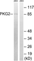 PRKG2 / CGKII Antibody - Western blot analysis of lysates from 293 cells, treated with anisomycin 25ug/ml 30', using PKG2 Antibody. The lane on the right is blocked with the synthesized peptide.