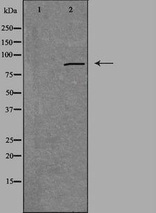 PRKG2 / CGKII Antibody - Western blot analysis of extracts of HuvEc cells using CGK 2 antibody. The lane on the left is treated with the antigen-specific peptide.