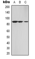 PRKG2 / CGKII Antibody - Western blot analysis of cGK 2 expression in A549 (A); NIH3T3 (B); HEK293T (C) whole cell lysates.