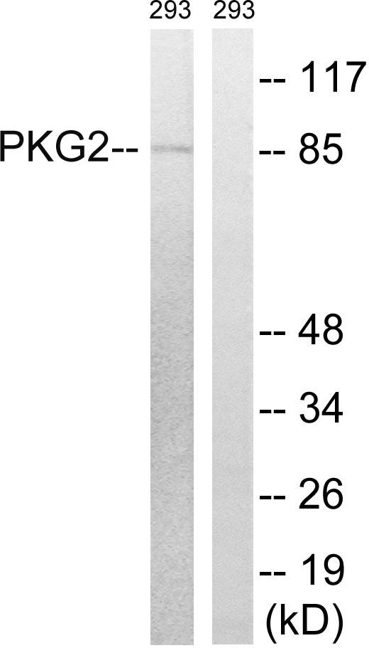 PRKG2 / CGKII Antibody - Western blot analysis of extracts from 293 cells, treated with anisomycin (25ug/ml, 30mins), using PKG2 (Ab-126) antibody.