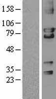 PRKG2 / CGKII Protein - Western validation with an anti-DDK antibody * L: Control HEK293 lysate R: Over-expression lysate
