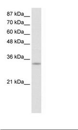 PRKRA / PACT Antibody - Jurkat Cell Lysate.  This image was taken for the unconjugated form of this product. Other forms have not been tested.