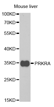 PRKRA / PACT Antibody - Western blot analysis of extracts of mouse liver.
