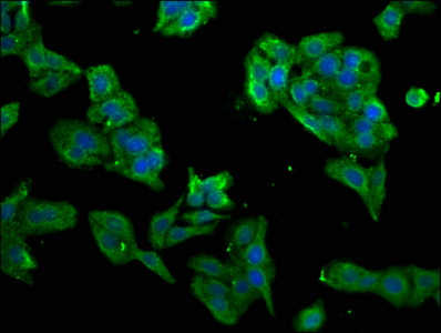 PRKRA / PACT Antibody - Immunofluorescence staining of HepG2 cells with PRKRA Antibody at 1:266, counter-stained with DAPI. The cells were fixed in 4% formaldehyde, permeabilized using 0.2% Triton X-100 and blocked in 10% normal Goat Serum. The cells were then incubated with the antibody overnight at 4°C. The secondary antibody was Alexa Fluor 488-congugated AffiniPure Goat Anti-Rabbit IgG(H+L).