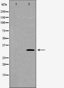 PRKRA / PACT Antibody - Western blot analysis of extracts of mouse liver tissue using PRKRA antibody. The lane on the left is treated with the antigen-specific peptide.