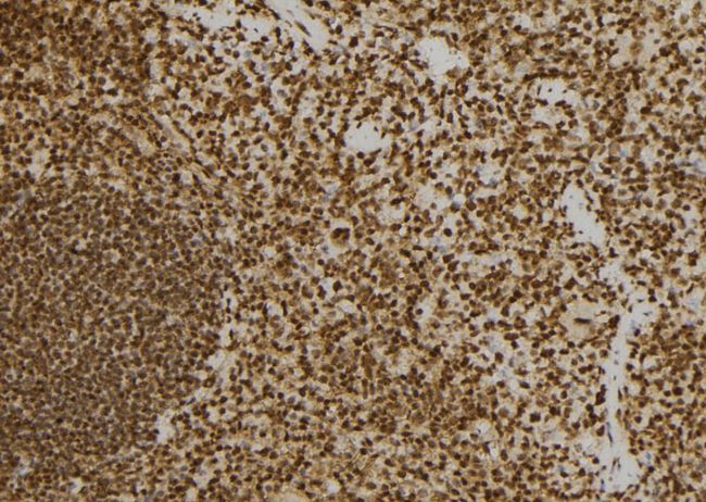 PRKRA / PACT Antibody - 1:100 staining mouse spleen tissue by IHC-P. The sample was formaldehyde fixed and a heat mediated antigen retrieval step in citrate buffer was performed. The sample was then blocked and incubated with the antibody for 1.5 hours at 22°C. An HRP conjugated goat anti-rabbit antibody was used as the secondary.