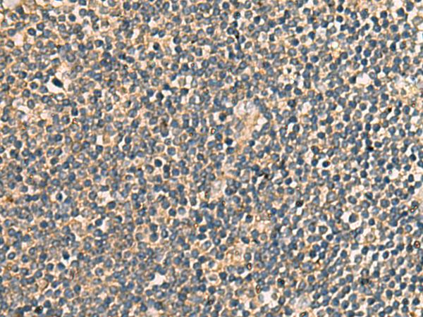 PRKRA / PACT Antibody - Immunohistochemistry of paraffin-embedded Human tonsil tissue  using PRKRA Polyclonal Antibody at dilution of 1:65(×200)