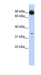 PRKRA / PACT Antibody - PRKRA / PACT antibody Western blot of Fetal Lung lysate. This image was taken for the unconjugated form of this product. Other forms have not been tested.