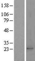 PRKRIP1 Protein - Western validation with an anti-DDK antibody * L: Control HEK293 lysate R: Over-expression lysate