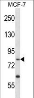 PRKRIR Antibody - PRKRIR Antibody western blot of MCF-7 cell line lysates (35 ug/lane). The PRKRIR antibody detected the PRKRIR protein (arrow).