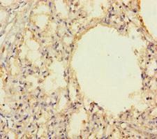 PRKRIR Antibody - Immunohistochemistry of paraffin-embedded human lung tissue using THAP12 Antibody at dilution of 1:100