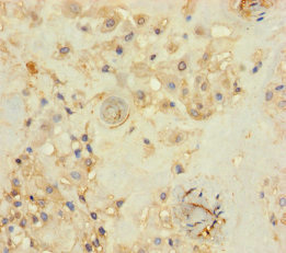 PRKRIR Antibody - Immunohistochemistry of paraffin-embedded human placenta tissue using THAP12 Antibody at dilution of 1:100