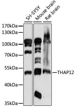 PRKRIR Antibody - Western blot analysis of extracts of various cell lines, using THAP12 antibody at 1:1000 dilution. The secondary antibody used was an HRP Goat Anti-Rabbit IgG (H+L) at 1:10000 dilution. Lysates were loaded 25ug per lane and 3% nonfat dry milk in TBST was used for blocking. An ECL Kit was used for detection and the exposure time was 30s.