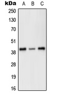PRKX Antibody - Western blot analysis of PRKX expression in HEK293T (A); SP2/0 (B); H9C2 (C) whole cell lysates.