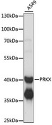 PRKX Antibody - Western blot analysis of extracts of A549 cells, using PRKX antibody at 1:1000 dilution. The secondary antibody used was an HRP Goat Anti-Rabbit IgG (H+L) at 1:10000 dilution. Lysates were loaded 25ug per lane and 3% nonfat dry milk in TBST was used for blocking. An ECL Kit was used for detection and the exposure time was 1s.
