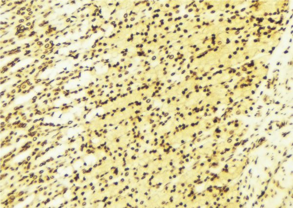 PRKX Antibody - 1:100 staining human gastric tissue by IHC-P. The sample was formaldehyde fixed and a heat mediated antigen retrieval step in citrate buffer was performed. The sample was then blocked and incubated with the antibody for 1.5 hours at 22°C. An HRP conjugated goat anti-rabbit antibody was used as the secondary.