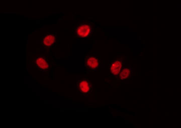 PRKX Antibody - Staining A549 cells by IF/ICC. The samples were fixed with PFA and permeabilized in 0.1% Triton X-100, then blocked in 10% serum for 45 min at 25°C. The primary antibody was diluted at 1:200 and incubated with the sample for 1 hour at 37°C. An Alexa Fluor 594 conjugated goat anti-rabbit IgG (H+L) Ab, diluted at 1/600, was used as the secondary antibody.