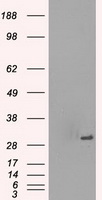 PRKY Antibody - HEK293T cells were transfected with the pCMV6-ENTRY control (Left lane) or pCMV6-ENTRY PRKY (Right lane) cDNA for 48 hrs and lysed. Equivalent amounts of cell lysates (5 ug per lane) were separated by SDS-PAGE and immunoblotted with anti-PRKY.