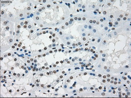 PRKY Antibody - Immunohistochemical staining of paraffin-embedded Kidney tissue using anti-PRKY mouse monoclonal antibody. (Dilution 1:50).