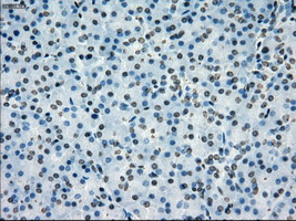 PRKY Antibody - Immunohistochemical staining of paraffin-embedded pancreas tissue using anti-PRKY mouse monoclonal antibody. (Dilution 1:50).