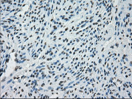 PRKY Antibody - Immunohistochemical staining of paraffin-embedded endometrium tissue using anti-PRKY mouse monoclonal antibody. (Dilution 1:50).