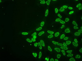 PRKY Antibody - Immunofluorescent staining of HeLa cells using anti-PRKY mouse monoclonal antibody.