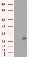 PRKY Antibody - HEK293T cells were transfected with the pCMV6-ENTRY control (Left lane) or pCMV6-ENTRY PRKY (Right lane) cDNA for 48 hrs and lysed. Equivalent amounts of cell lysates (5 ug per lane) were separated by SDS-PAGE and immunoblotted with anti-PRKY.