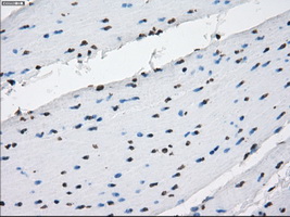 PRKY Antibody - Immunohistochemical staining of paraffin-embedded colon tissue using anti-PRKY mouse monoclonal antibody. (Dilution 1:50).