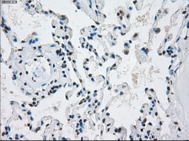 PRKY Antibody - Immunohistochemical staining of paraffin-embedded lung tissue using anti-PRKY mouse monoclonal antibody. (Dilution 1:50).