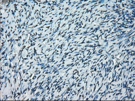 PRKY Antibody - Immunohistochemical staining of paraffin-embedded Ovary tissue using anti-PRKY mouse monoclonal antibody. (Dilution 1:50).