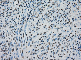 PRKY Antibody - Immunohistochemical staining of paraffin-embedded endometrium tissue using anti-PRKY mouse monoclonal antibody. (Dilution 1:50).