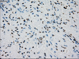 PRKY Antibody - Immunohistochemical staining of paraffin-embedded prostate tissue using anti-PRKY mouse monoclonal antibody. (Dilution 1:50).