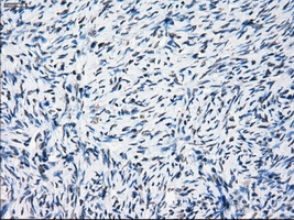 PRKY Antibody - Immunohistochemical staining of paraffin-embedded Ovary tissue using anti-PRKY mouse monoclonal antibody. (Dilution 1:50).
