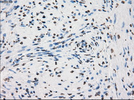 PRKY Antibody - Immunohistochemical staining of paraffin-embedded prostate tissue using anti-PRKY mouse monoclonal antibody. (Dilution 1:50).