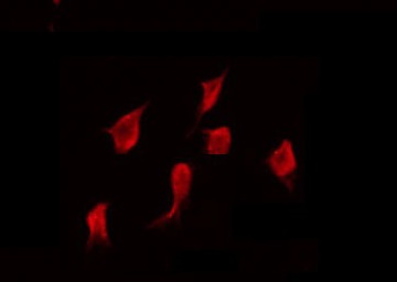 PRKY Antibody - Staining HeLa cells by IF/ICC. The samples were fixed with PFA and permeabilized in 0.1% Triton X-100, then blocked in 10% serum for 45 min at 25°C. The primary antibody was diluted at 1:200 and incubated with the sample for 1 hour at 37°C. An Alexa Fluor 594 conjugated goat anti-rabbit IgG (H+L) Ab, diluted at 1/600, was used as the secondary antibody.
